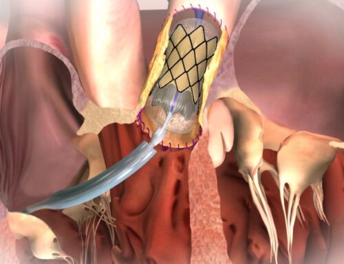 Hospital Santo António confirma estar a preparar unidade para válvulas aórticas percutâneas
