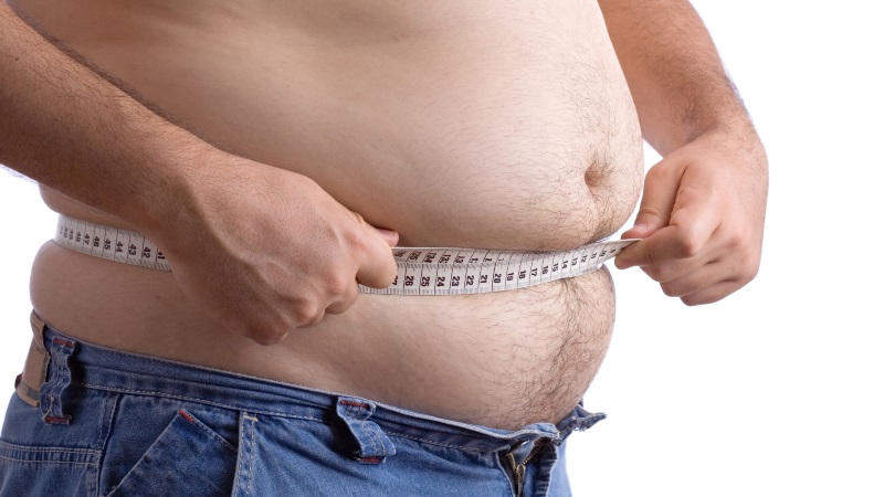 Obesidade3 Projeto investiga forma de reduzir desigualdades no tratamento da obesidade