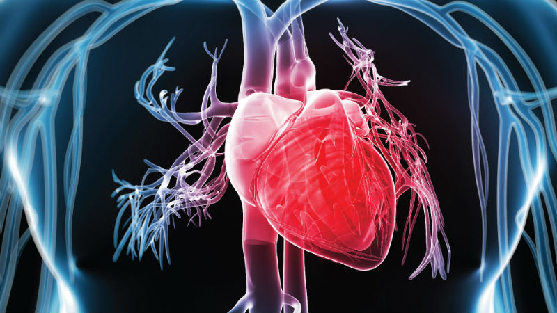 CTO, APIC, cardiologia, doenças cardíacas doença coronária