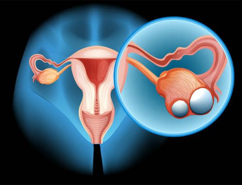 Cancro do ovário é o cancro ginecológico com a maior taxa de mortalidade em Portugal