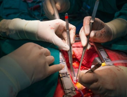  Cirurgia a artéria carótida. Algoritmo da FMUP consegue prever risco de problemas neurológicos
