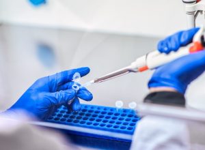 testes de vacinas covid-19 medicamento, investigação