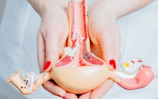 endometriose