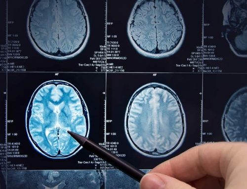  CE autoriza tratamento para as fases sintomáticas mais precoces da doença de Alzheimer