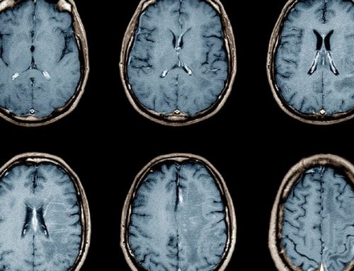 Cientistas identificam zonas cerebrais afetadas por tensão arterial alta