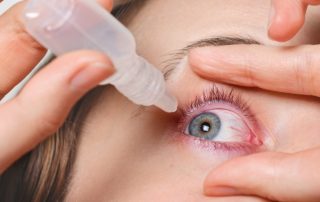 SPO - alerta conjuntivite