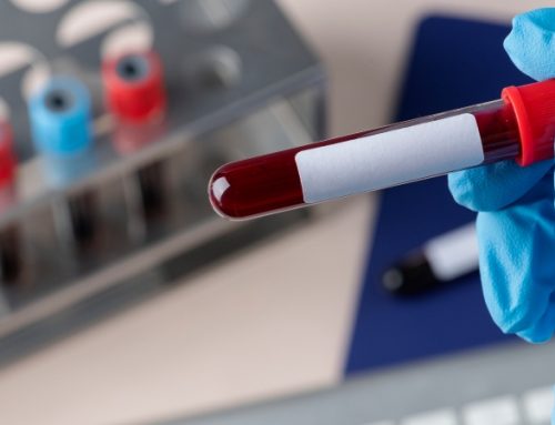  Gasto do Estado em análises clínicas sobe e atinge 244 milhões em 2024