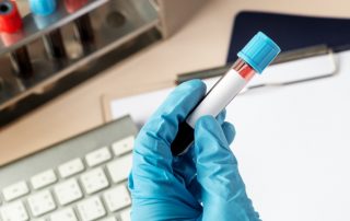 níveis de hemoglobina