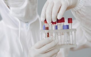 hipertensão - níveis minerais