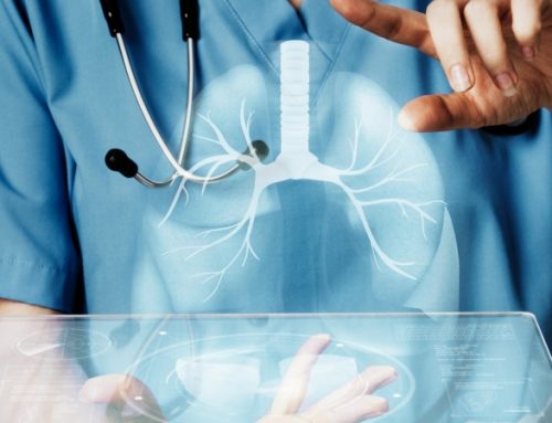 Fibrose Pulmonar Idiopática. Pneumologistas alertam para atraso no diagnóstico