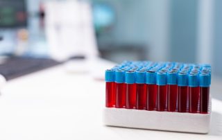 deficiência de ferro