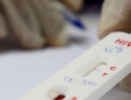 Diagnósticos de VIH aumentaram no ano passado e ultrapassaram valores de 2019