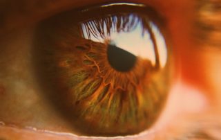 retina