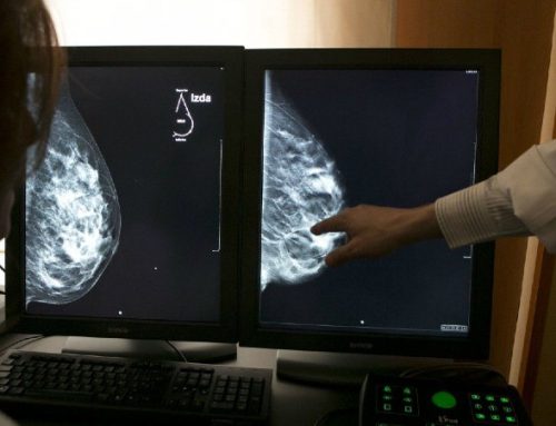  Em apenas 80 dias tratamento eliminou metástases do cancro da mama