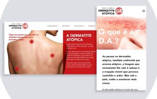 dermatite atopica