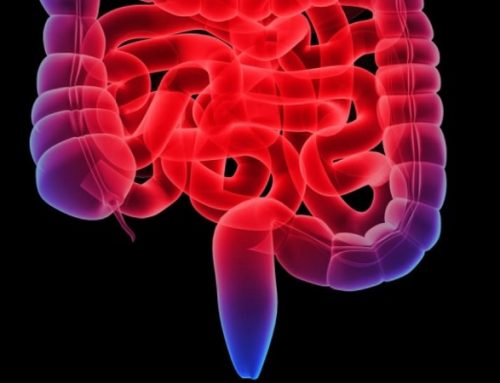  Doença de Crohn. Remissão sem esteroides durante três anos com o único inibidor da IL-23p19