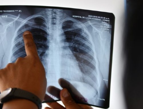 Casos de tuberculose diminuíram em 2021, mas diagnóstico ainda é tardio, indica relatório