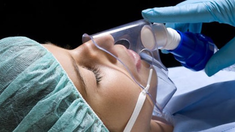 anestesias