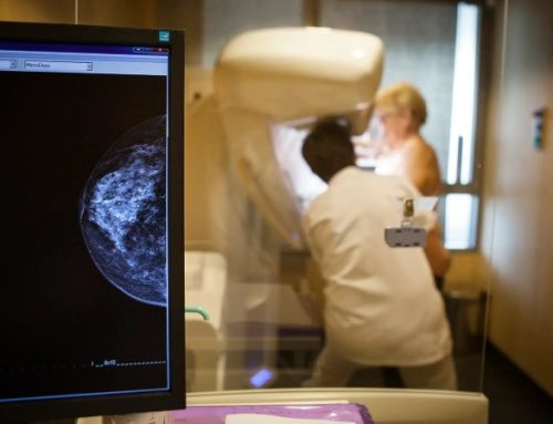  Adaptar tratamento do cancro da mama à resposta permite evitar quimioterapia, indica estudo