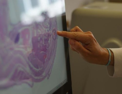 Rastreios vão ser alargados aos cancros do pulmão, próstata e estômago já em 2023