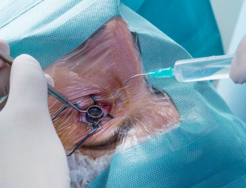 Mulher cega recupera visão com transplante inédito em Itália
