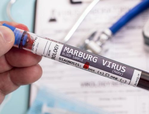 Risco “relativamente baixo” de Portugal ser afetado por vírus Marburg, diz especialista