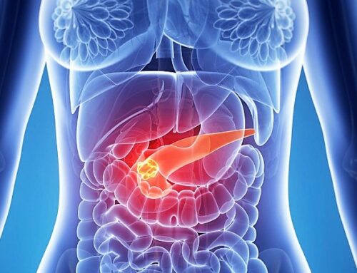  Vacina experimental para prevenir cancro do pâncreas com resultados positivos